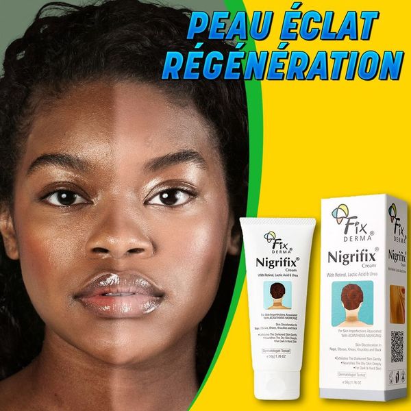 La Crème Correctrice de pigmentation des Visage, Main, Coudes et Genou -RDC